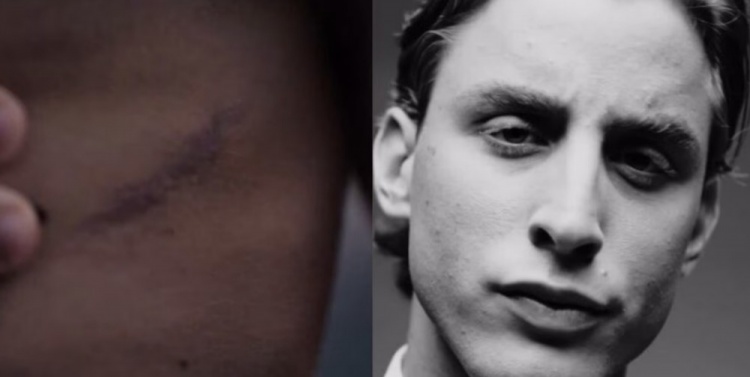 罗体：博维首度公开心脏手术疤痕，为香水品牌拍摄广告